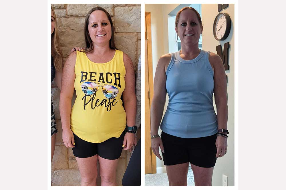 Why Can’t I Lose Weight? The Hidden Causes of Weight Resistance